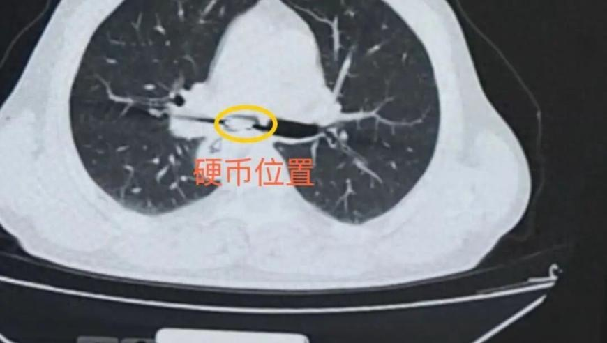 2025噢門天天開好彩大全,特朗普宣布对进口汽车征收25%关税,准确资料解释落实_GM版V12.57